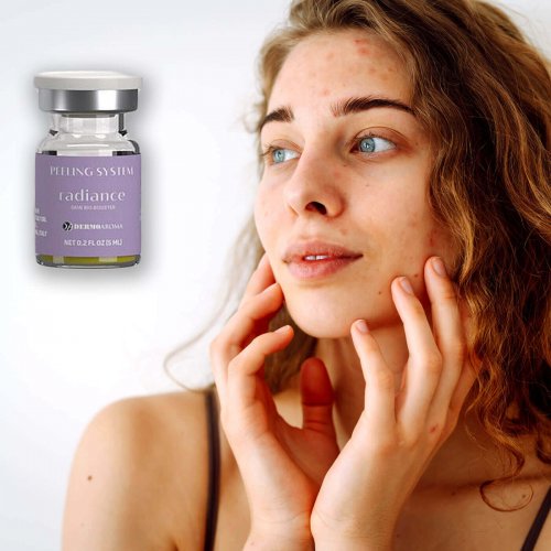 Peeling-System-radiance-foto