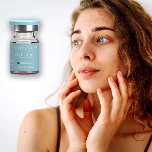 Peeling-System-cell-renew-foto